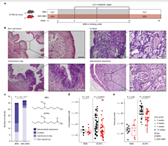How Bacterial Metabolism of Environmental Carcinogens Drives Bladder Tumorigenesis