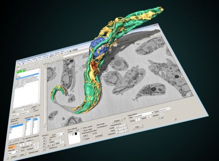 Vabilo na predavanji o 3D elektronski mikroskopiji gostujočih raziskovalcev z Univerze v Helsinkih