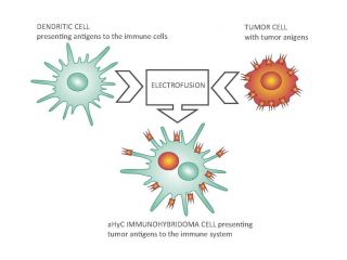 New Generation of Advanced Cell-Based Medicine for Personalized Immunotherapy of Castration-Resistant Prostate Cancer